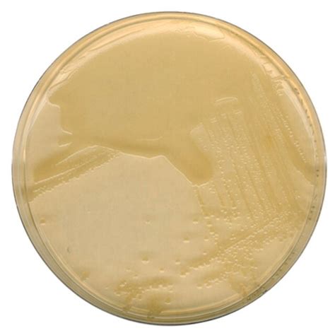 lb agar plate instructions